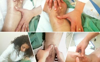 Cicatrici e fisioterapia
