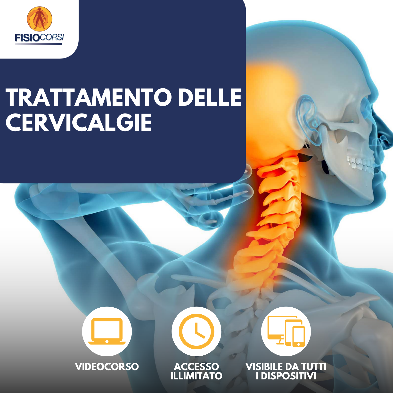 VIDEOCORSO CERVICALGIA