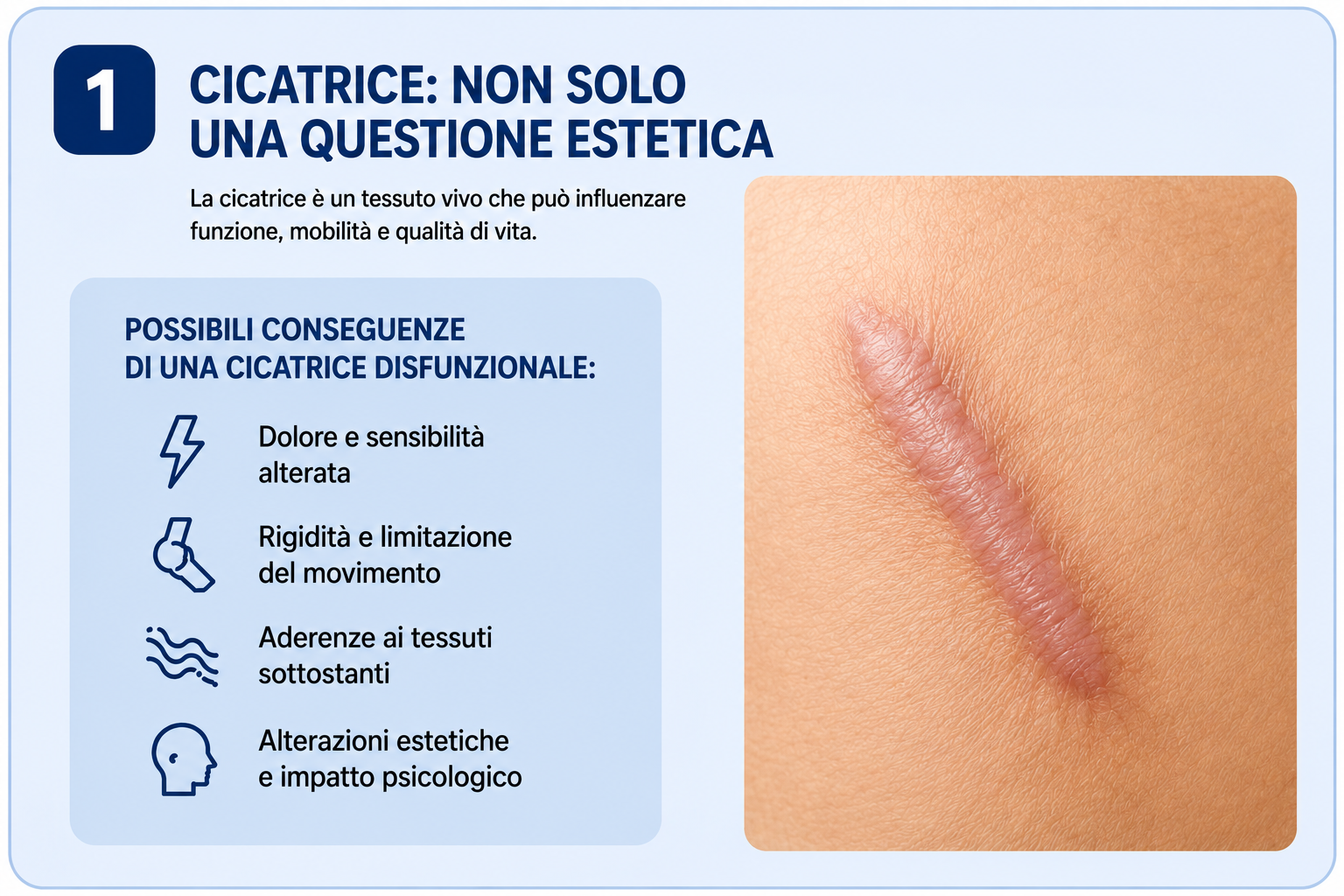 trattamento cicatrici in fisioterapia